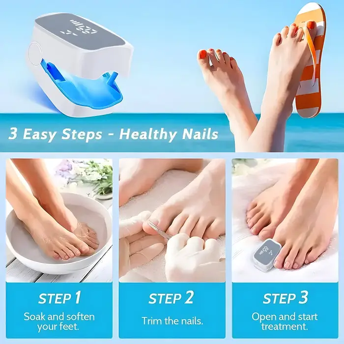 Outils de traitement des champignons des ongles à infrarouge, élimine les champignons des ongles des orteils, Infection fongique des ongles, Anti-équipement efficace, Machine Rechargeable