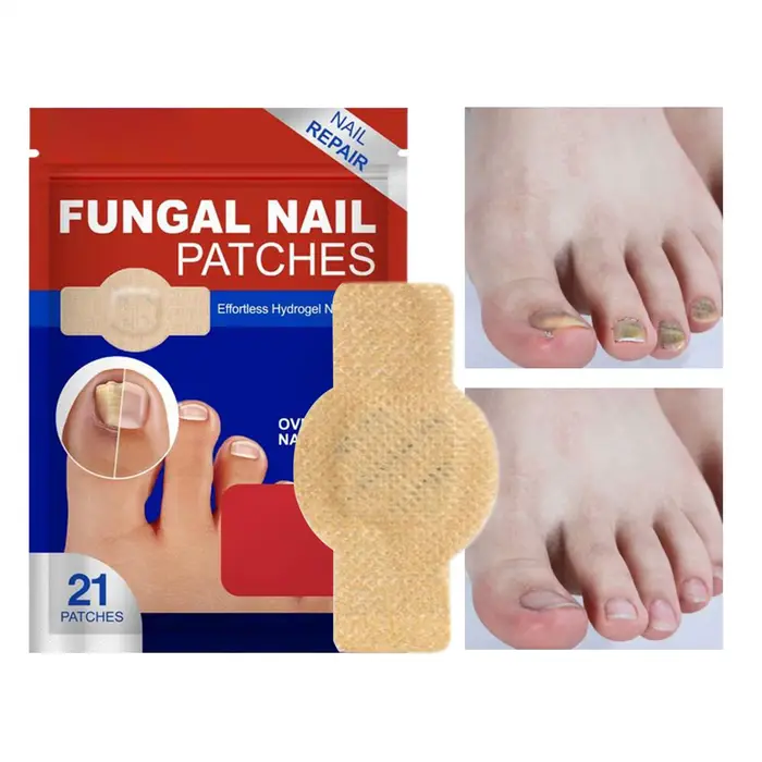 Patch imperméable réparation des ongles