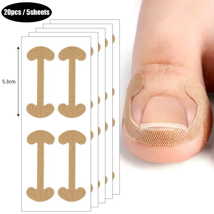 Bandes correctrices pour ongles incarnés