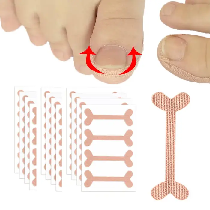 Autocollants de Correction des ongles incarnés