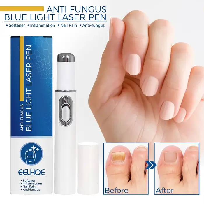 Stylo fongique pour ongles chauds