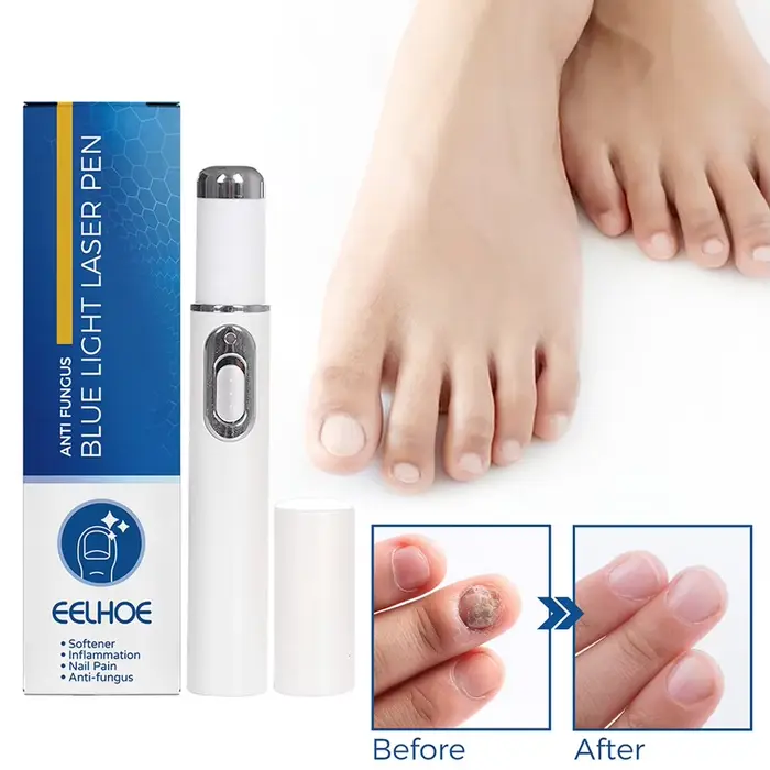 Stylo fongique pour ongles chauds