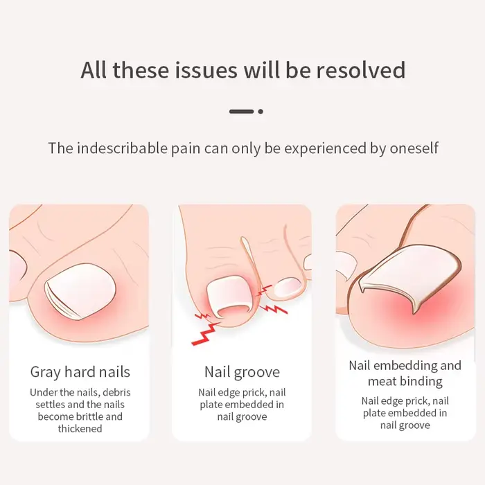Coupe-ongles pour pédicure et manucure