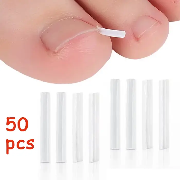 Outil de Correction des ongles incarnés, 50 pièces, tampon de traitement des ongles incarnés invisib