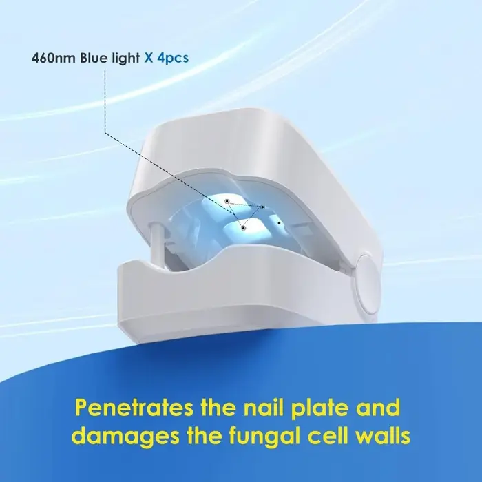Outils de traitement des champignons des ongles à infrarouge, élimine les champignons des ongles des orteils, Infection fongique des ongles, Anti-équipement efficace, Machine Rechargeable