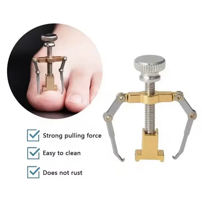 Outil de correction pour ongles incarnés