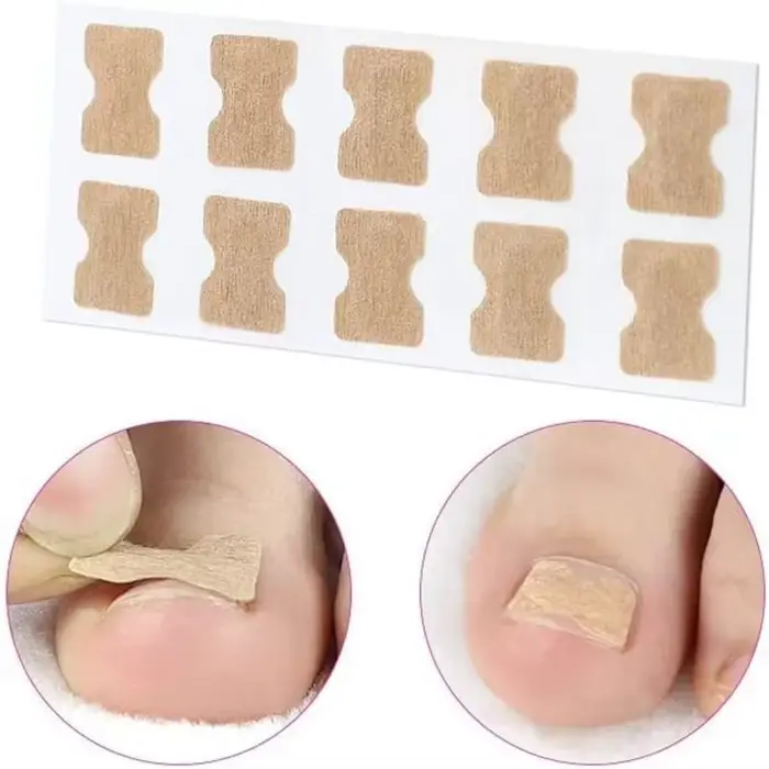 Ensemble de Correction des ongles incarnés