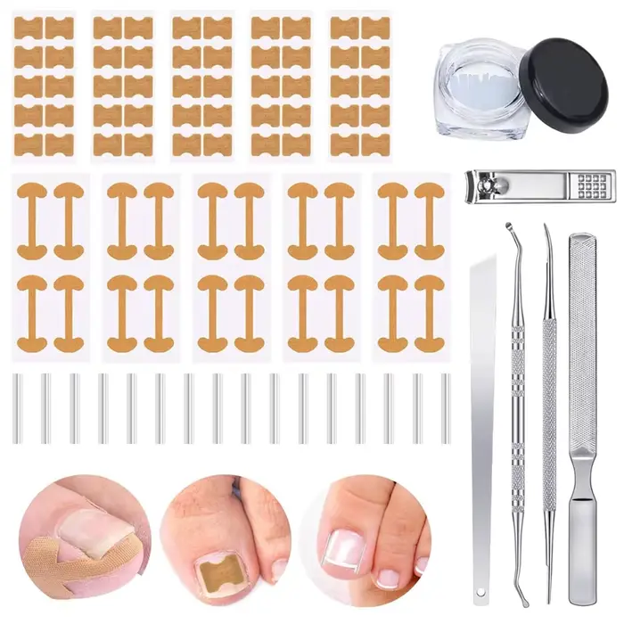 Ensemble de Correction des ongles incarnés, Patch autocollant, outil de pédicure, traitement des ong