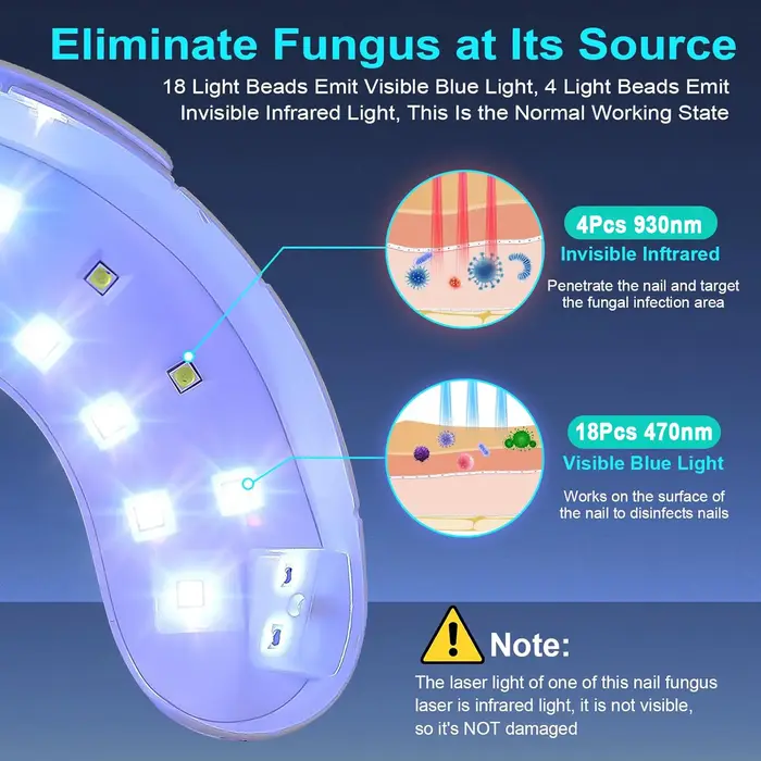 Appareil de traitement laser antifongique pour les ongles, réparation des ongles des mains et des pieds, machine anti-infection pour l'onychomycose, la paronychie et les ongles incarnés