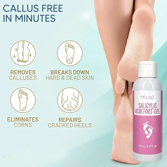 Gel pour les pieds à l'acide salicylique MELAO - Élimine les peaux mortes et les callosités, traitement exfoliant pour les pieds rugueux et gercés, adoucit les talons, 150 ml
