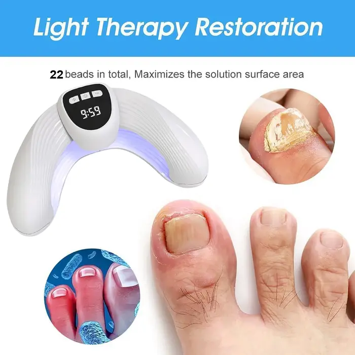 Dispositif de traitement au Laser pour champignons des ongles