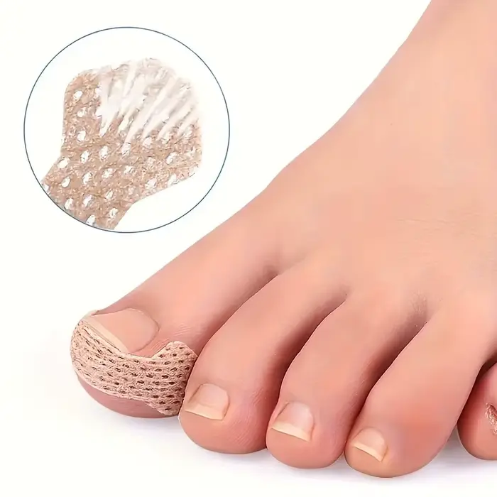 Outils spéciaux pour les ongles incarnés