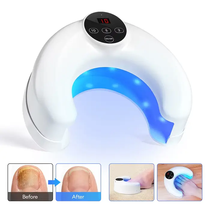 Appareil laser pour le traitement des ongles