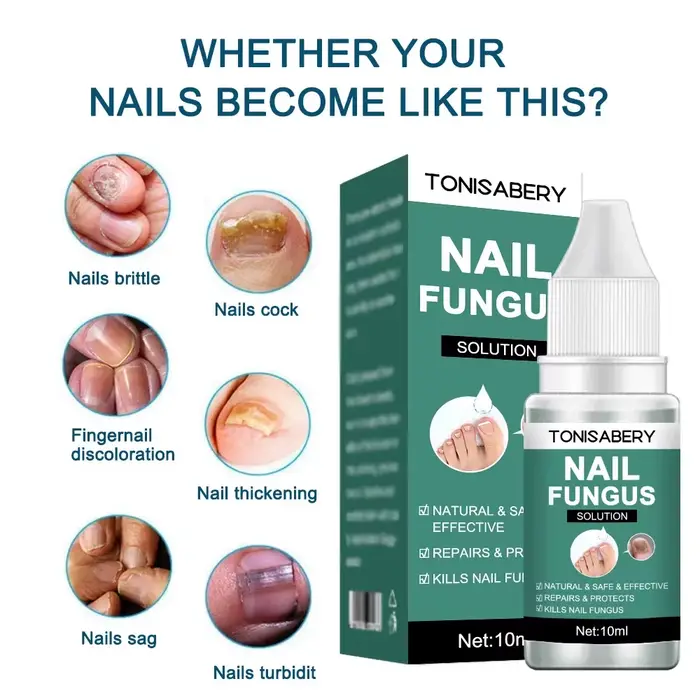 Sérum de traitement des champignons des ongles, liquide de réparation des pieds, Gel d'élimination d