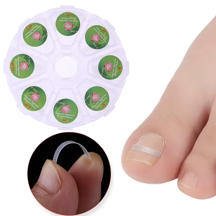100 pièces/boîte pédicure incarnée ongle redressage pince orteil autocollant outils opération pratique Simple commodité