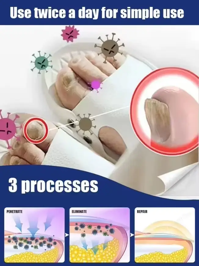 Élimine rapidement les champignons et restaurer les ongles sains 9