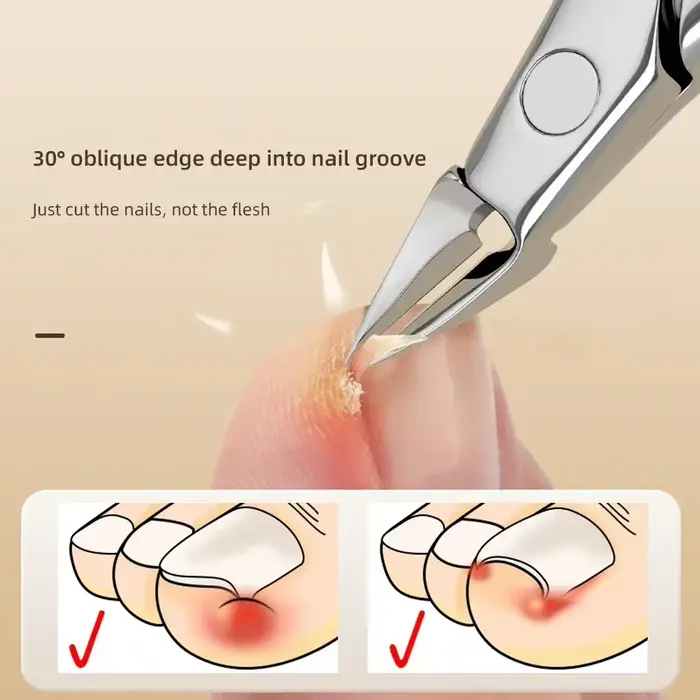 Coupe-ongles unique, rainure d'ongles spécialisée