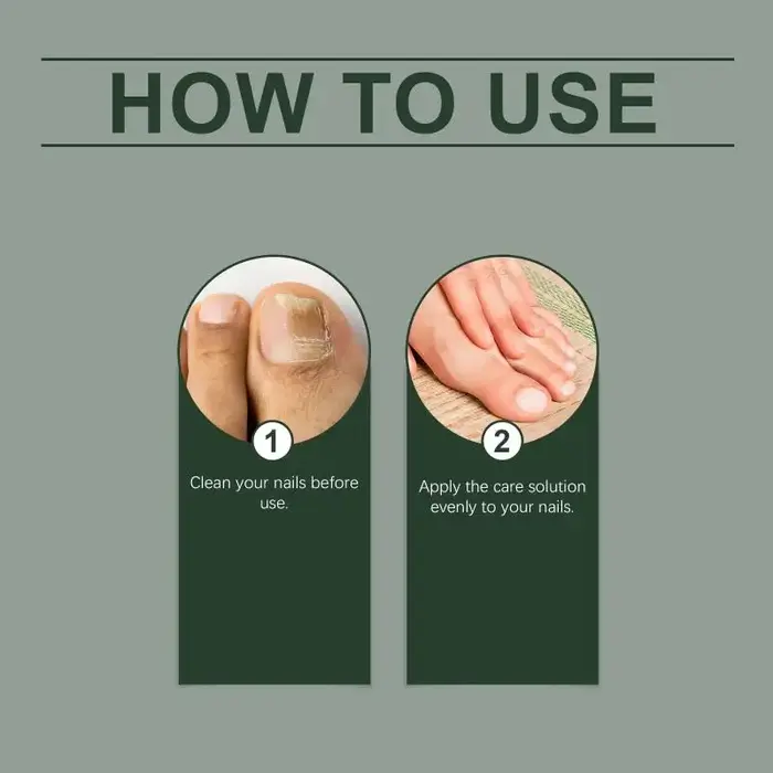 Solution de soin des ongles pour la réparation des infections fongiques et la nutrition des ongles abîmés avec des ingrédients fortifiants, utilisation à domicile