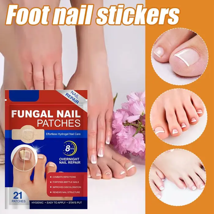 Autocollant de Correction des ongles incarnés