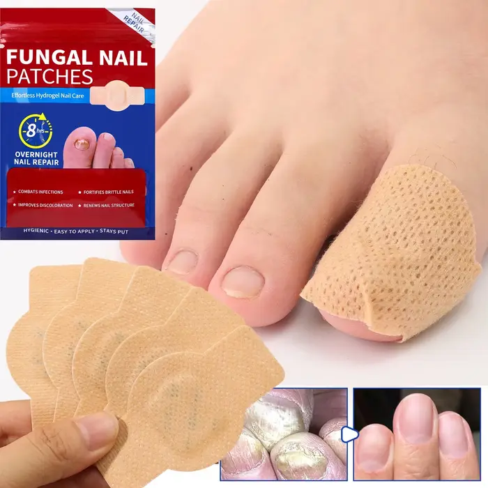 Patch imperméable pour les champignons des ongles incarnés