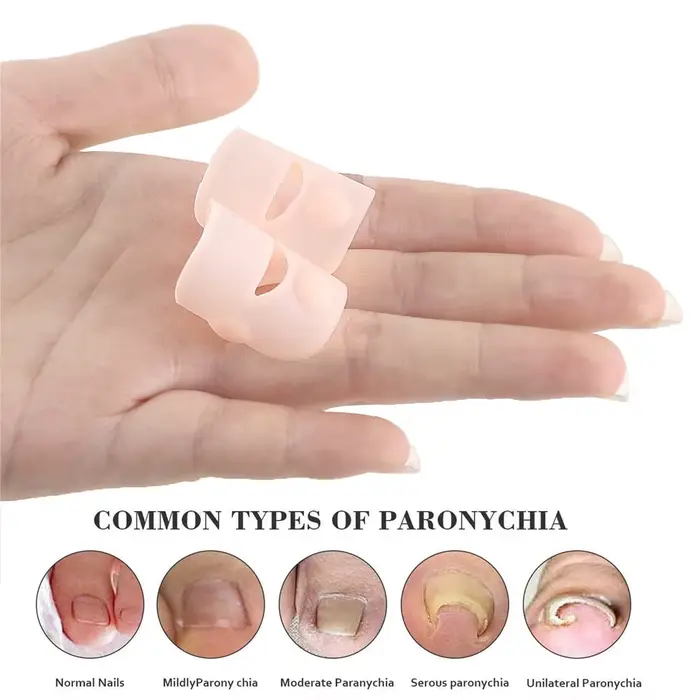 Pexmen 2/4/10 pièces Gel correcteur d'ongle incarné manches gros orteil ongles guérison soins protecteurs Paronychia traitement pédicure outil
