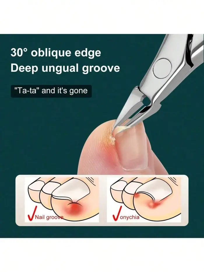 Coupe-ongles professionnel à bec d'aigle allemand – Coupe-ongles de précision pour ongles épais, idé