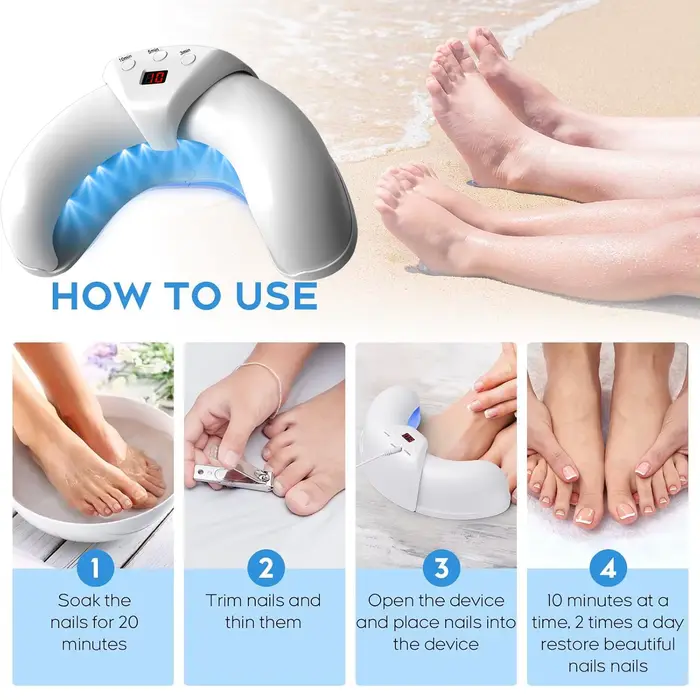 Dispositif de traitement au Laser pour champignons des ongles