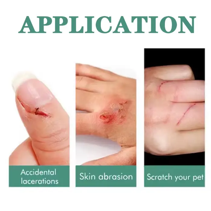 Agent hémostatique officiel authentique pour ongles