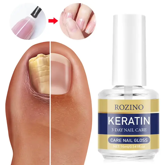 Kératins 3 jours de croissance traitement des ongles hommes renforcement fixer renouveler les dommages fongiques sérum