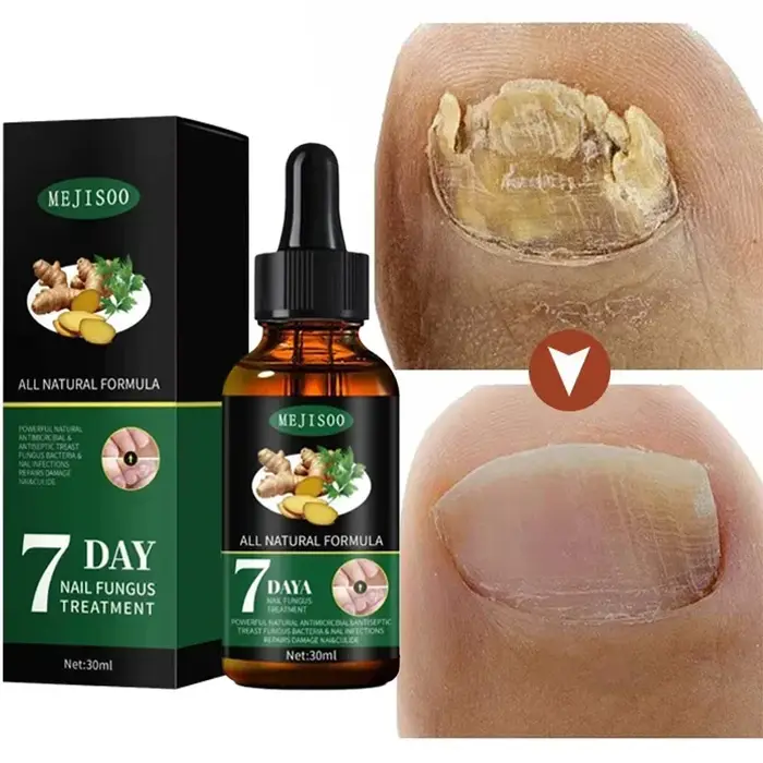 Huile de Soin des Ongles 7 Jours Formule Kératine Acides Aminés Séchage Rapide Brillance Salon Effet 90s Sans Écaillage Hydratation Profonde Renforceur d'Ongles Nouveau Produit