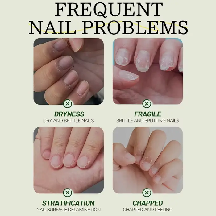 Huile de Soin des Ongles 7 Jours Formule Kératine Acides Aminés Séchage Rapide Brillance Salon Effet 90s Sans Écaillage Hydratation Profonde Renforceur d'Ongles Nouveau Produit