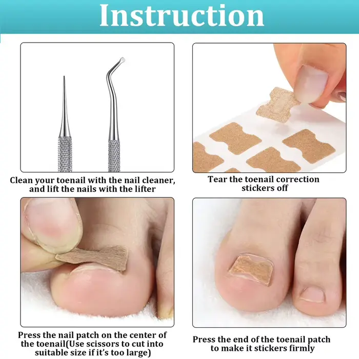 Patch autocollant pour traitement des ongles incarnés