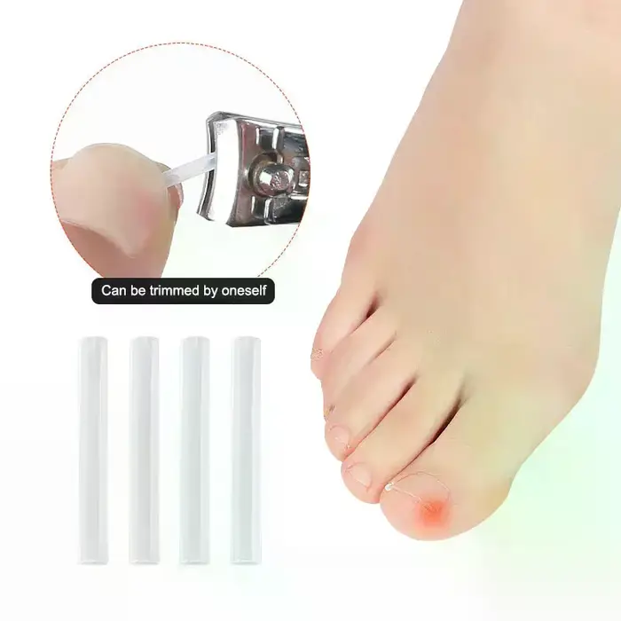 Ensemble d'autocollants correcteurs professionnels pour les ongles des pieds
