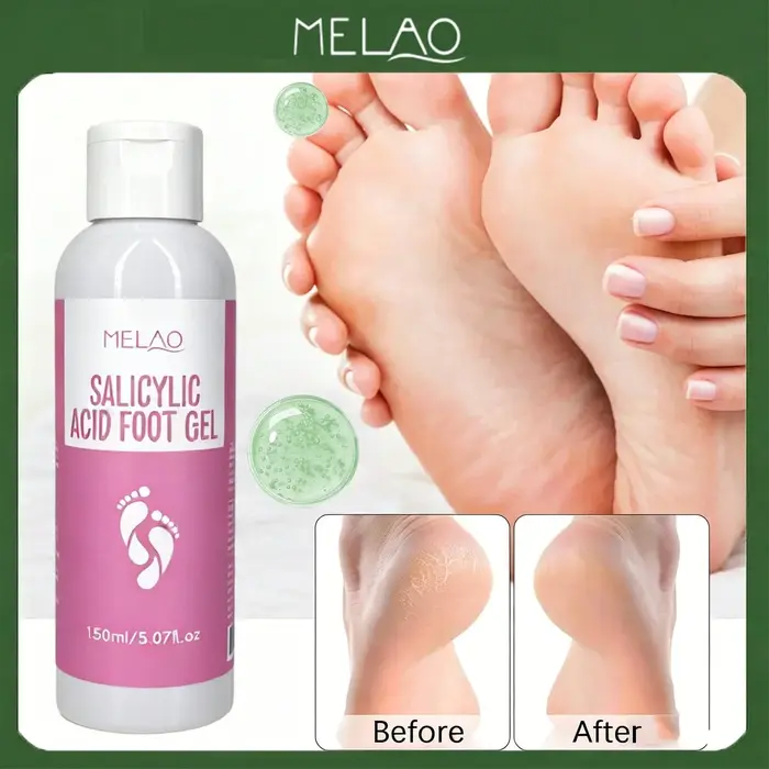 Gel pour les pieds à l'acide salicylique MELAO - Élimine les peaux mortes et les callosités, traitement exfoliant pour les pieds rugueux et gercés, adoucit les talons, 150 ml