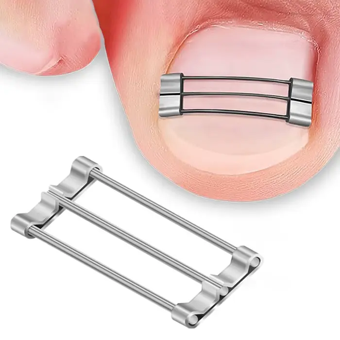 Correcteur d'ongles incarnés, outils de pédicure, récupération intégrée, traitement professionnel de