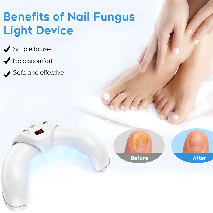 Appareil de traitement laser antifongique pour les ongles, réparation des ongles des mains et des pieds, machine anti-infection pour l'onychomycose, la paronychie et les ongles incarnés