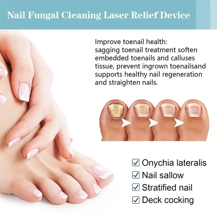 Appareil de traitement au laser pour champignon des ongles